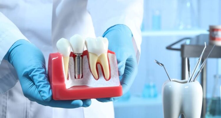 Implanty stomatologiczne – czy to najlepszy wybór?